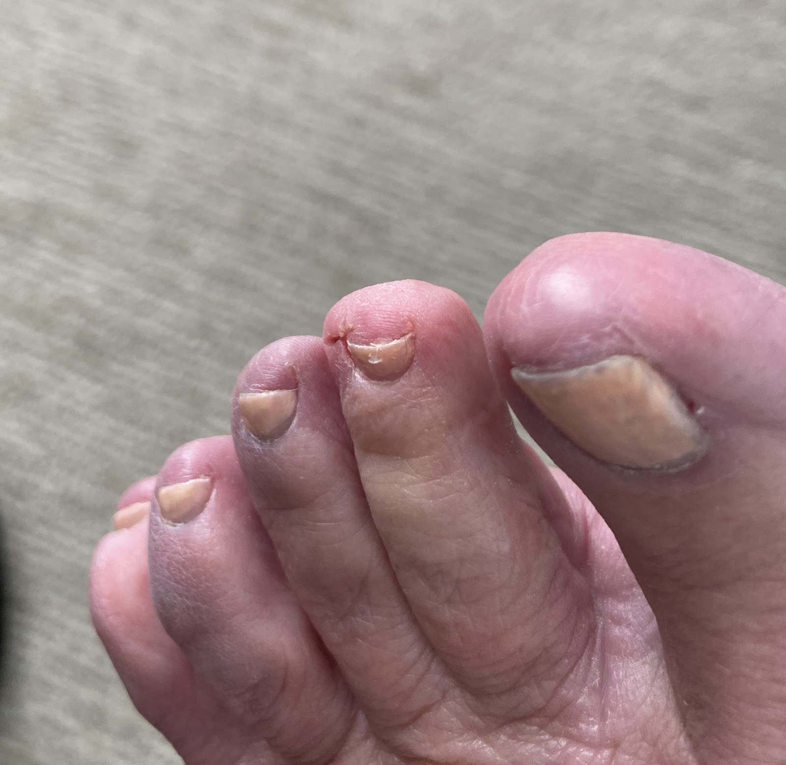 Nail 2000 nail photo 2